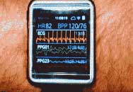 ƻiWatch10 ޷Ѫ