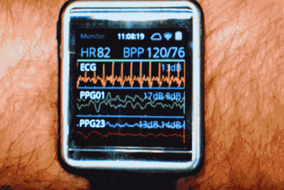 10ƻiWatchԲѪǣ