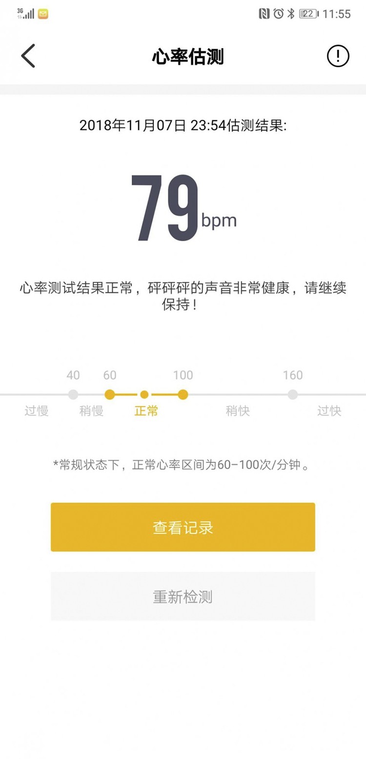 ����ƽ�� ������������ Watch X Plus����