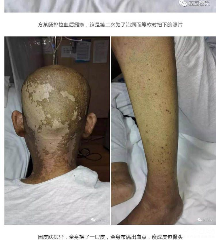 �µϳ��������������������Լ����ϰ�Ѫ��